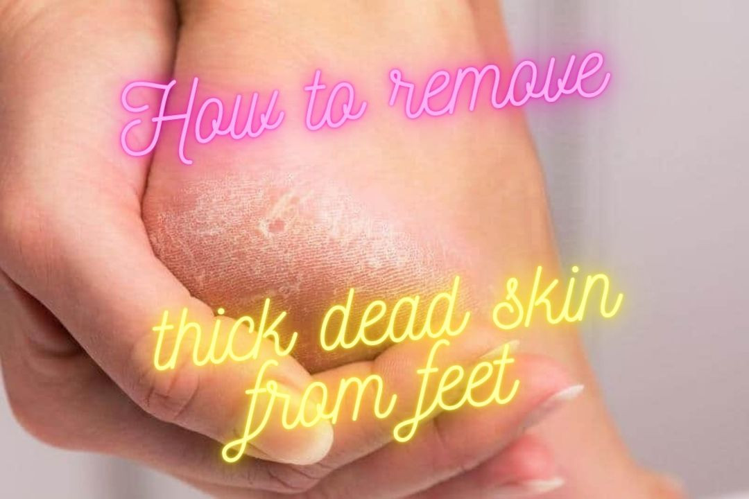 how-to-remove-thick-dead-skin-from-feet-5-ways-to-smoothen-your-feet